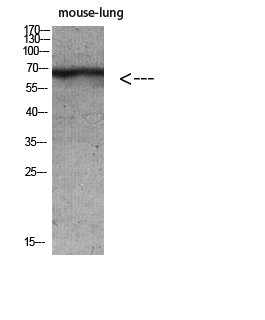 Anti-Cytokeratin Rabbit pAb