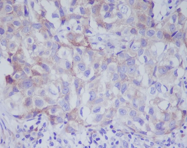 Anti-VAV2 Rabbit pAb