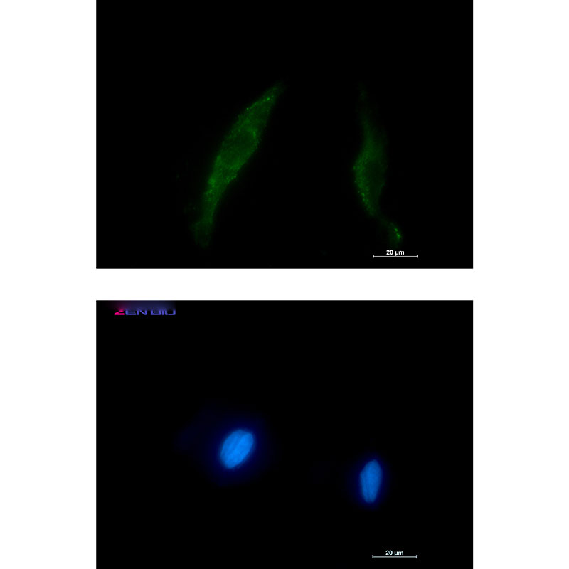 Anti-Smad2/3 Rabbit pAb