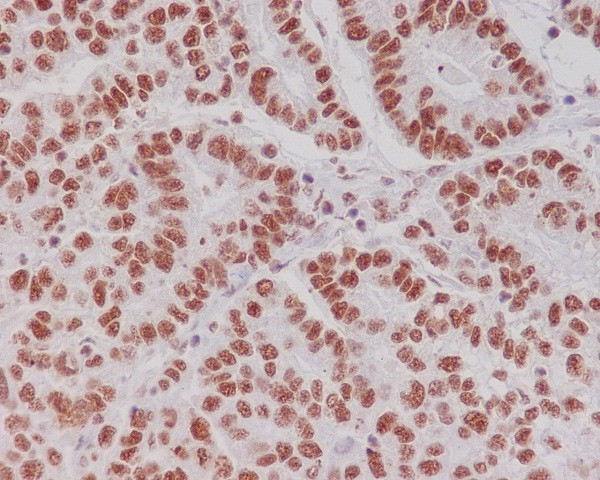Anti-Phospho-CREB (Ser133) Rabbit pAb