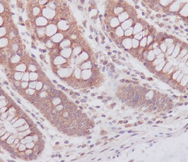 Anti-ATG7 Rabbit pAb