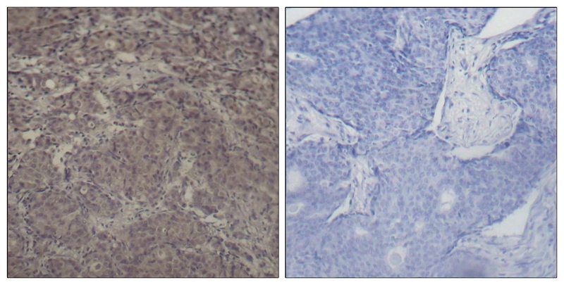 Anti-Phospho-CREB (Ser142) Rabbit pAb