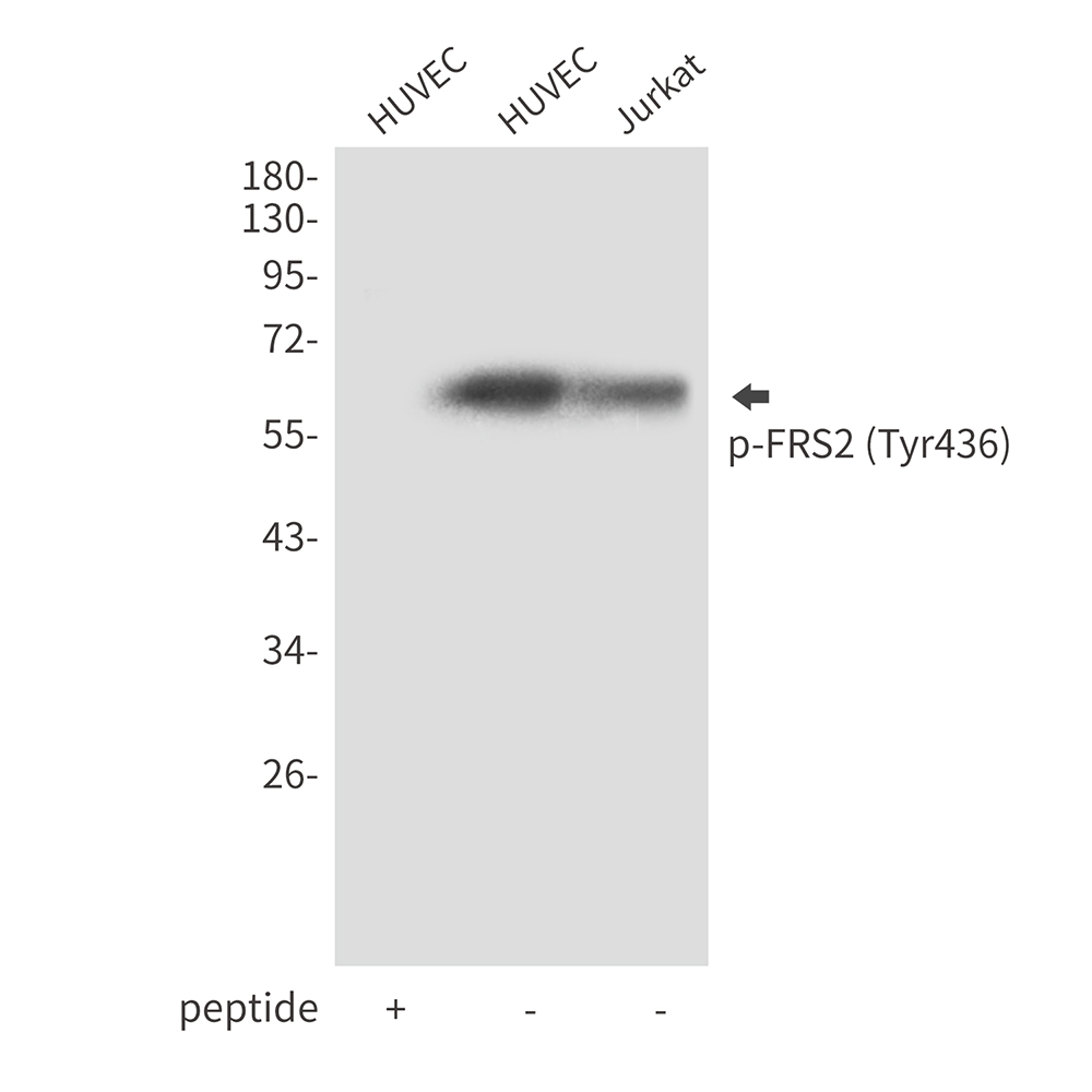 Anti-Phospho-FRS2 (Tyr436) Rabbit pAb