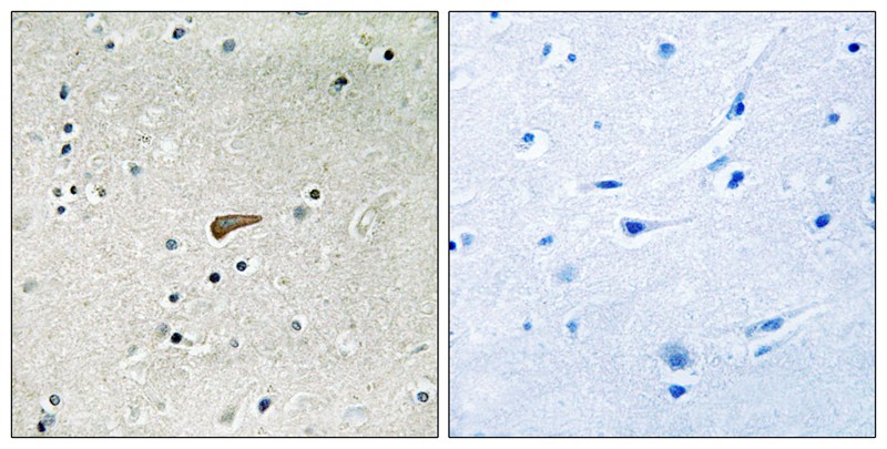 Anti-Phospho-FRS2 (Tyr436) Rabbit pAb