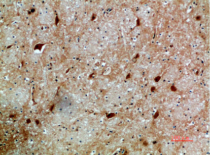 Anti-NFAT5 Rabbit pAb