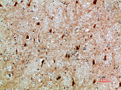 Anti-NFAT5 Rabbit pAb