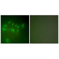 Anti-MDM2 Rabbit pAb