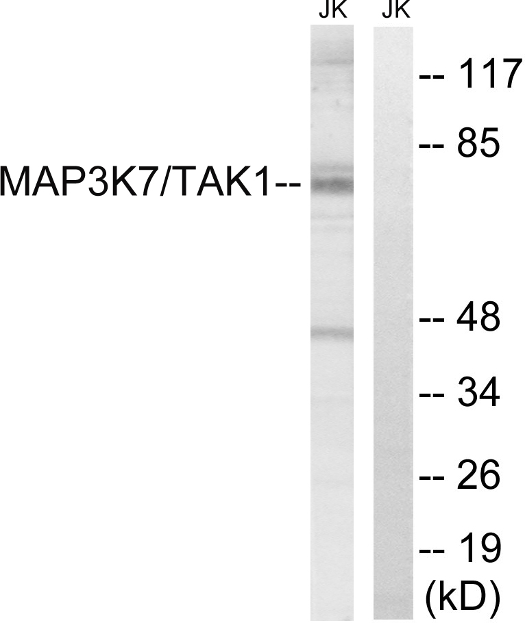 Anti-TAK1 Rabbit pAb