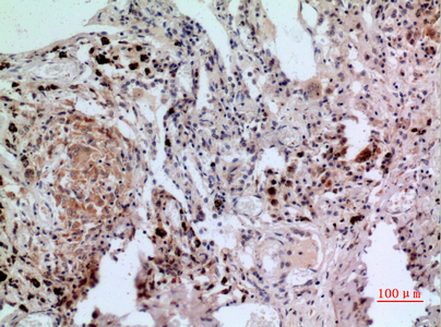 Anti-NFAT2 Rabbit pAb