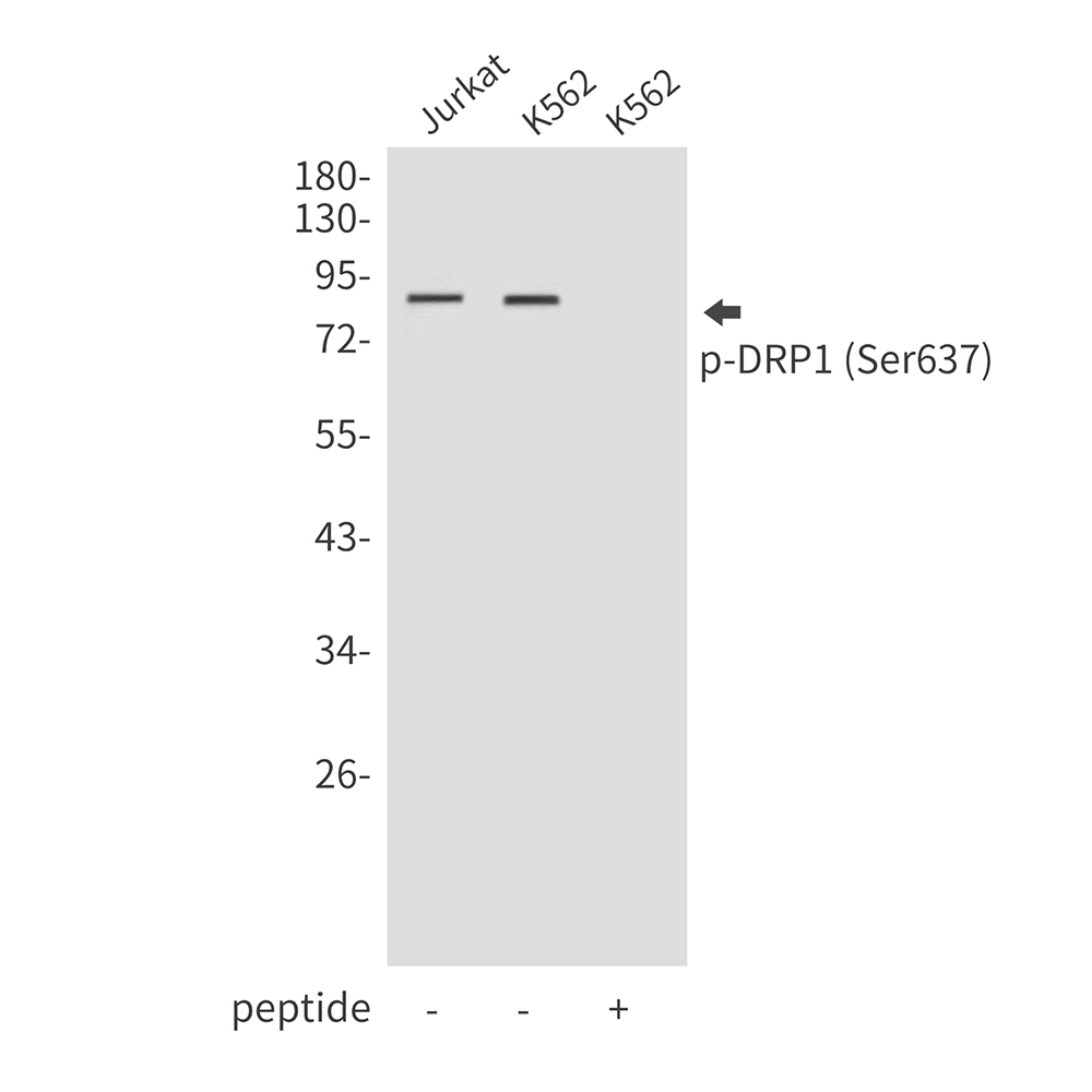 Anti-Phospho-DRP1 (Ser637) Rabbit pAb