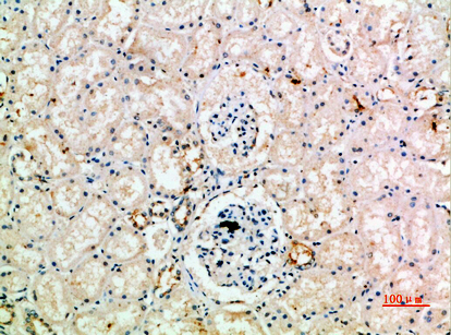 Anti-IL-18 Receptor Accessory Protein Rabbit pAb