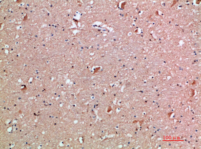 Anti-IL-18 Receptor Accessory Protein Rabbit pAb
