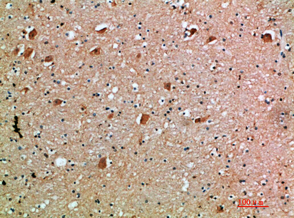 Anti-IL-18 Receptor Accessory Protein Rabbit pAb