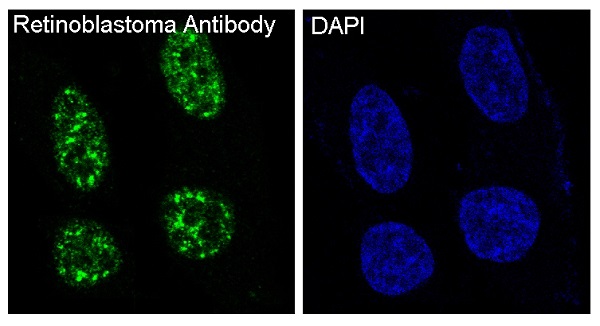 Anti-Rb Rabbit pAb