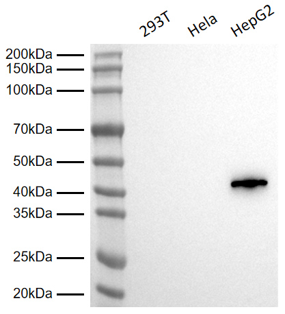 Anti-Cytokeratin 19 Rabbit pAb