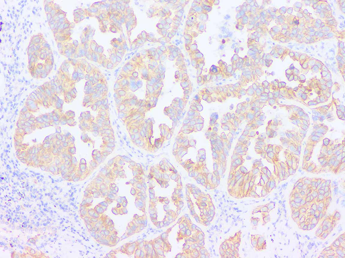 Anti-Cytokeratin 19 Rabbit pAb