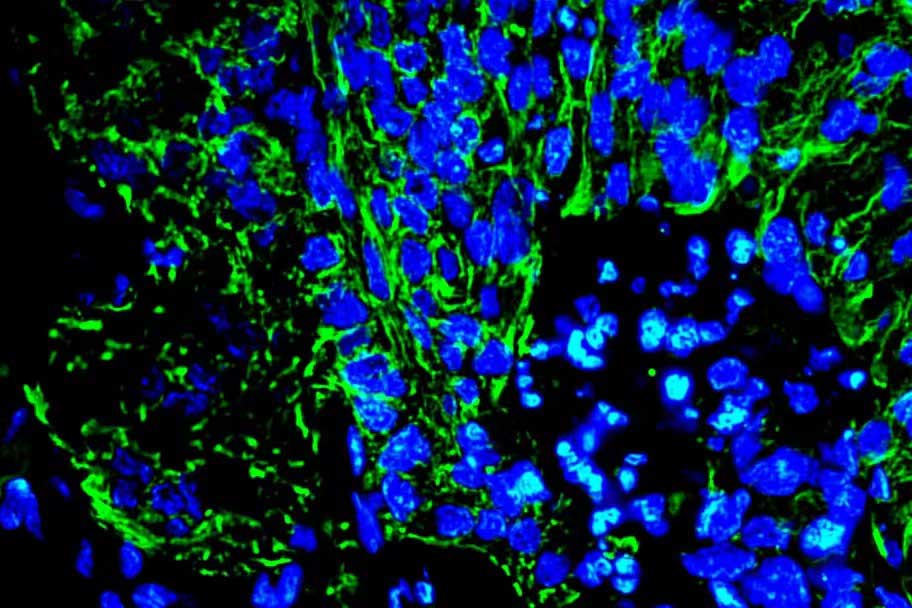 Anti-Cytokeratin 19 Rabbit pAb