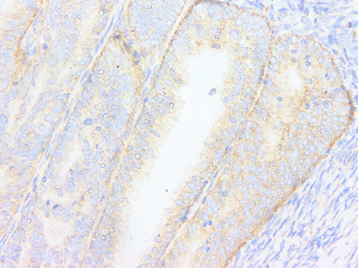 Anti-PDIA1 (PDI) Rabbit pAb