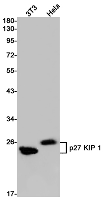 Anti-p27 Kip 1 Rabbit mAb [95L90K82]