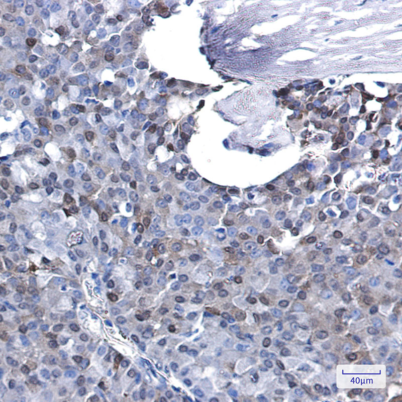 Anti-p27 Kip 1 Rabbit mAb [95L90K82]