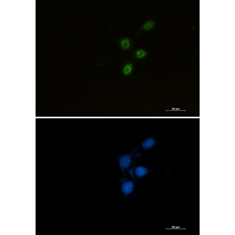 Anti-Chk2 Rabbit mAb [87K58K06]