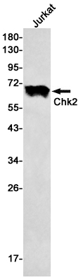 Anti-Chk2 Rabbit mAb [87K58K06]