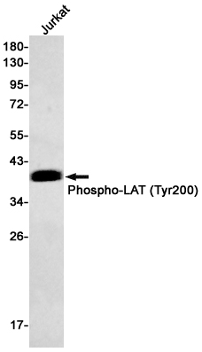 Anti-Phospho-LAT (Tyr200) Rabbit mAb [96L72M05]