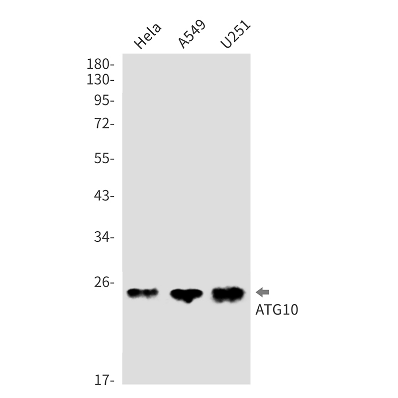 Anti-ATG10 Rabbit mAb [95M23L22]