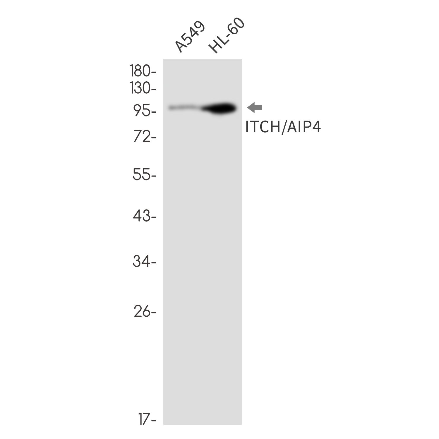 Anti-ITCH Rabbit mAb [15K77L14]