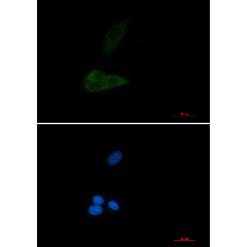 Anti-MAP3K4 Rabbit mAb [37M06K37]