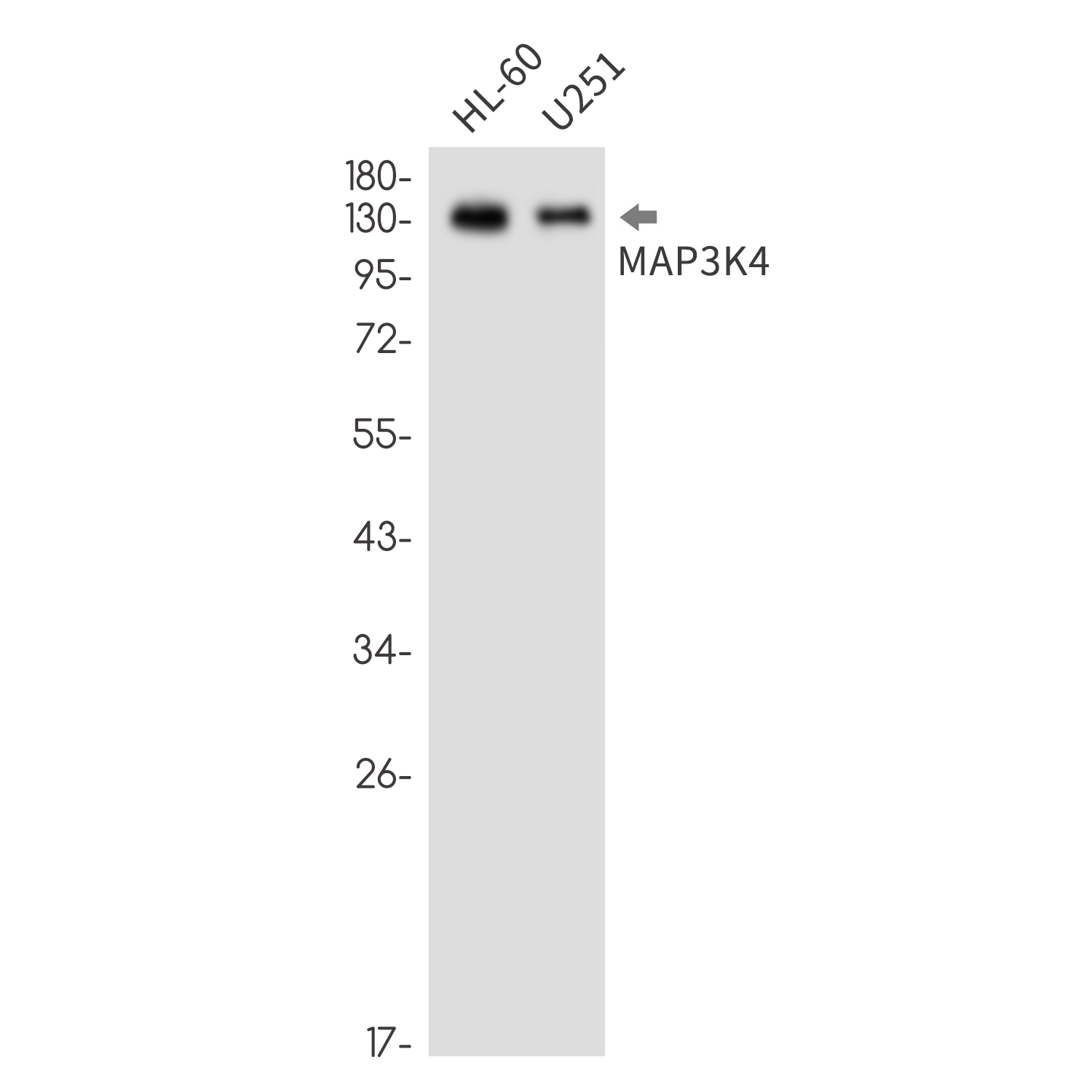 Anti-MAP3K4 Rabbit mAb [37M06K37]
