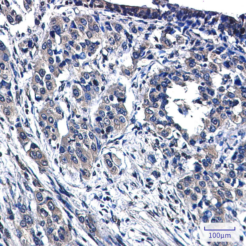 Anti-MAP3K4 Rabbit mAb [37M06K37]