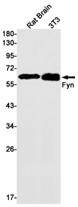 Anti-FYN Rabbit mAb [21L69M92]