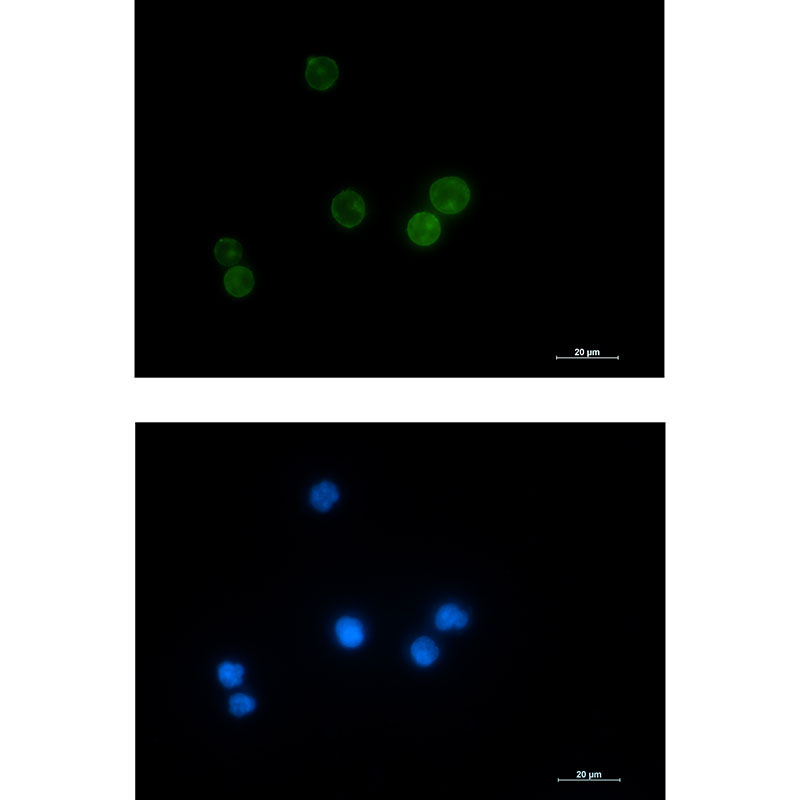 Anti-Lck Rabbit mAb [25K71L38]