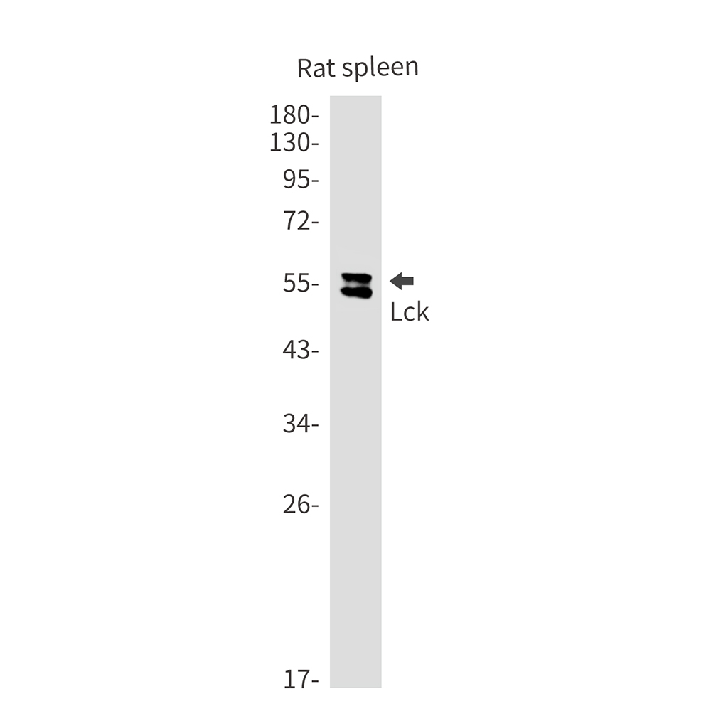 Anti-Lck Rabbit mAb [25K71L38]