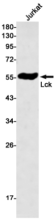 Anti-Lck Rabbit mAb [25K71L38]