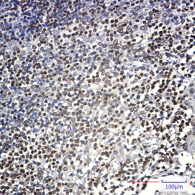 Anti-Lck Rabbit mAb [25K71L38]