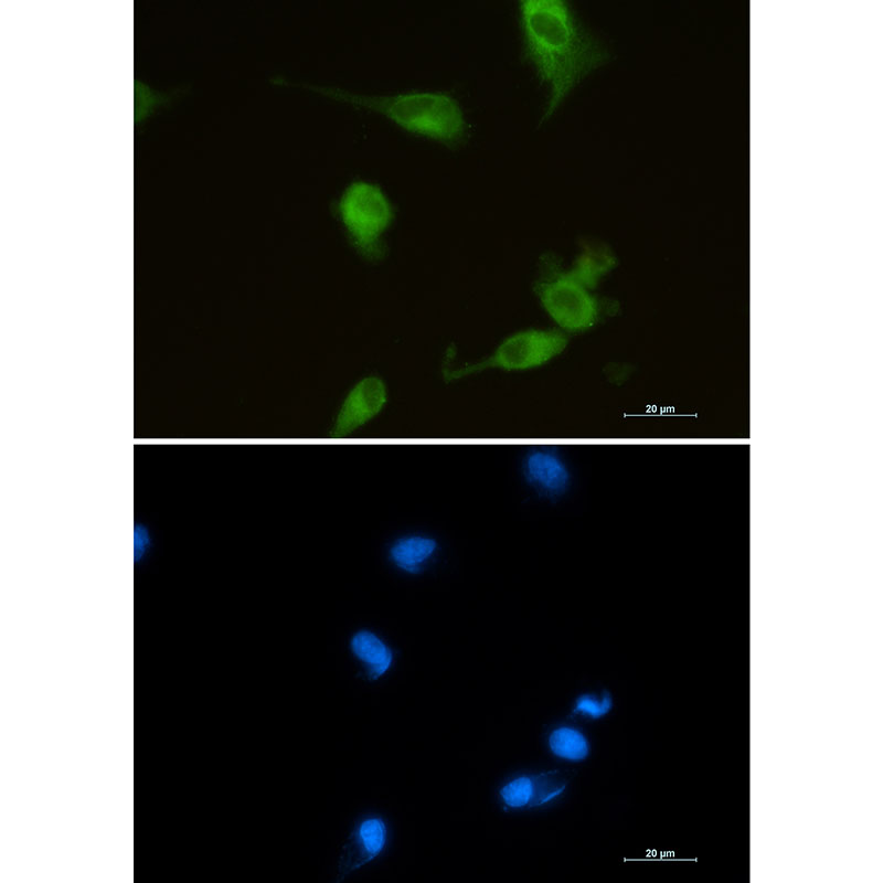 Anti-Heme Oxygenase 1 Rabbit mAb [10M21K72]