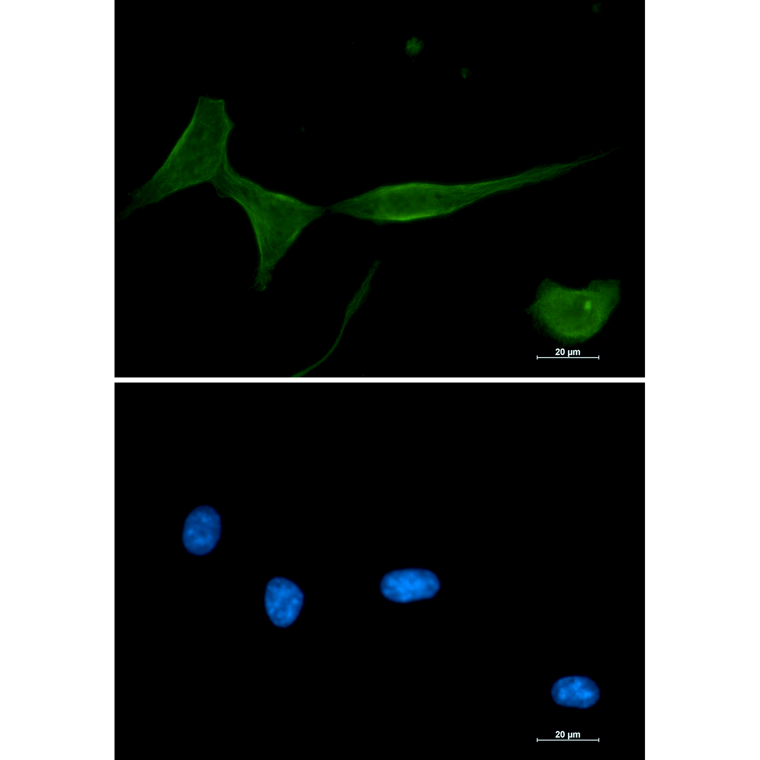 Anti-PKC delta Rabbit mAb [98M78L27]