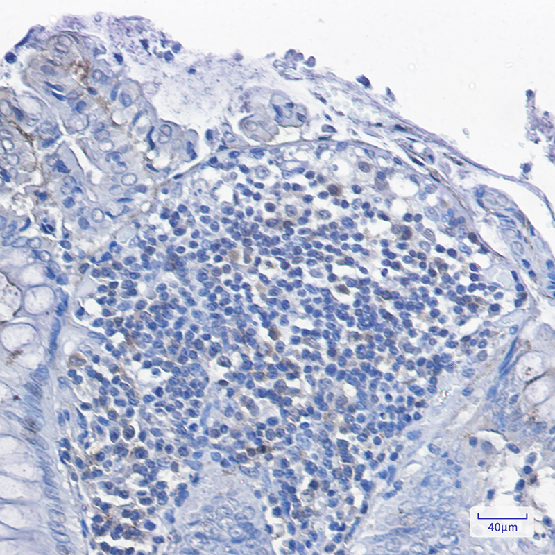 Anti-PKC delta Rabbit mAb [98M78L27]