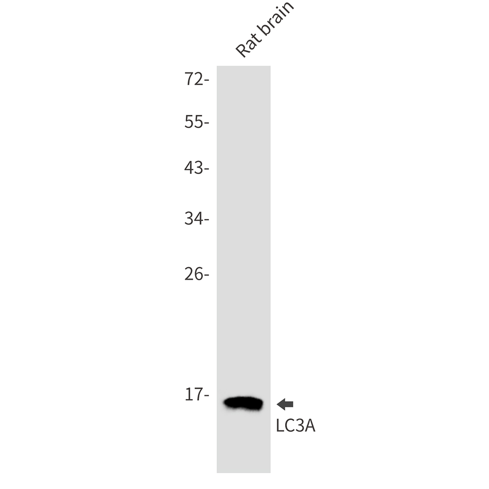 Anti-LC3A Rabbit mAb [18L98L12]