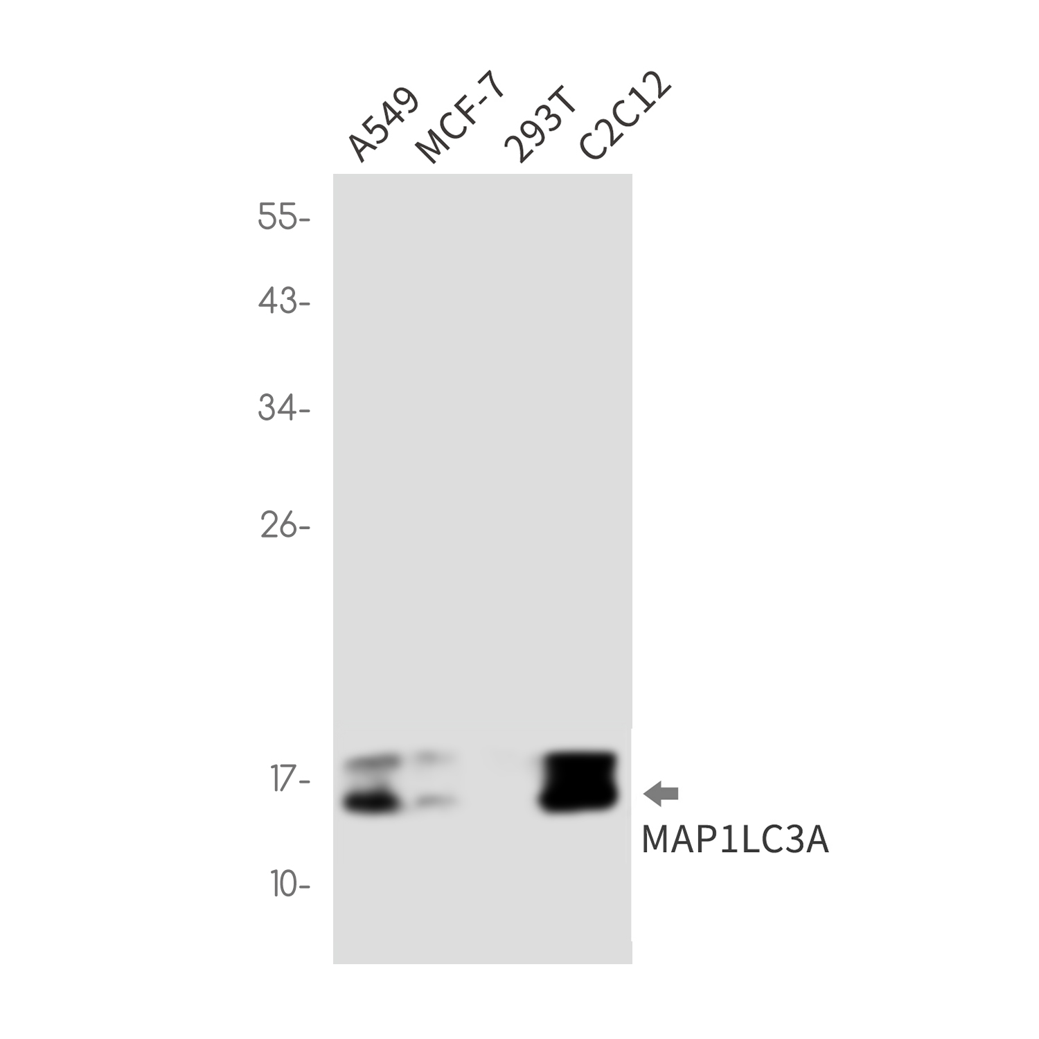 Anti-LC3A Rabbit mAb [18L98L12]