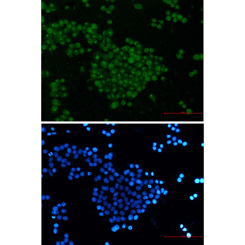 Anti-SKP2 Rabbit mAb [20L32L79]