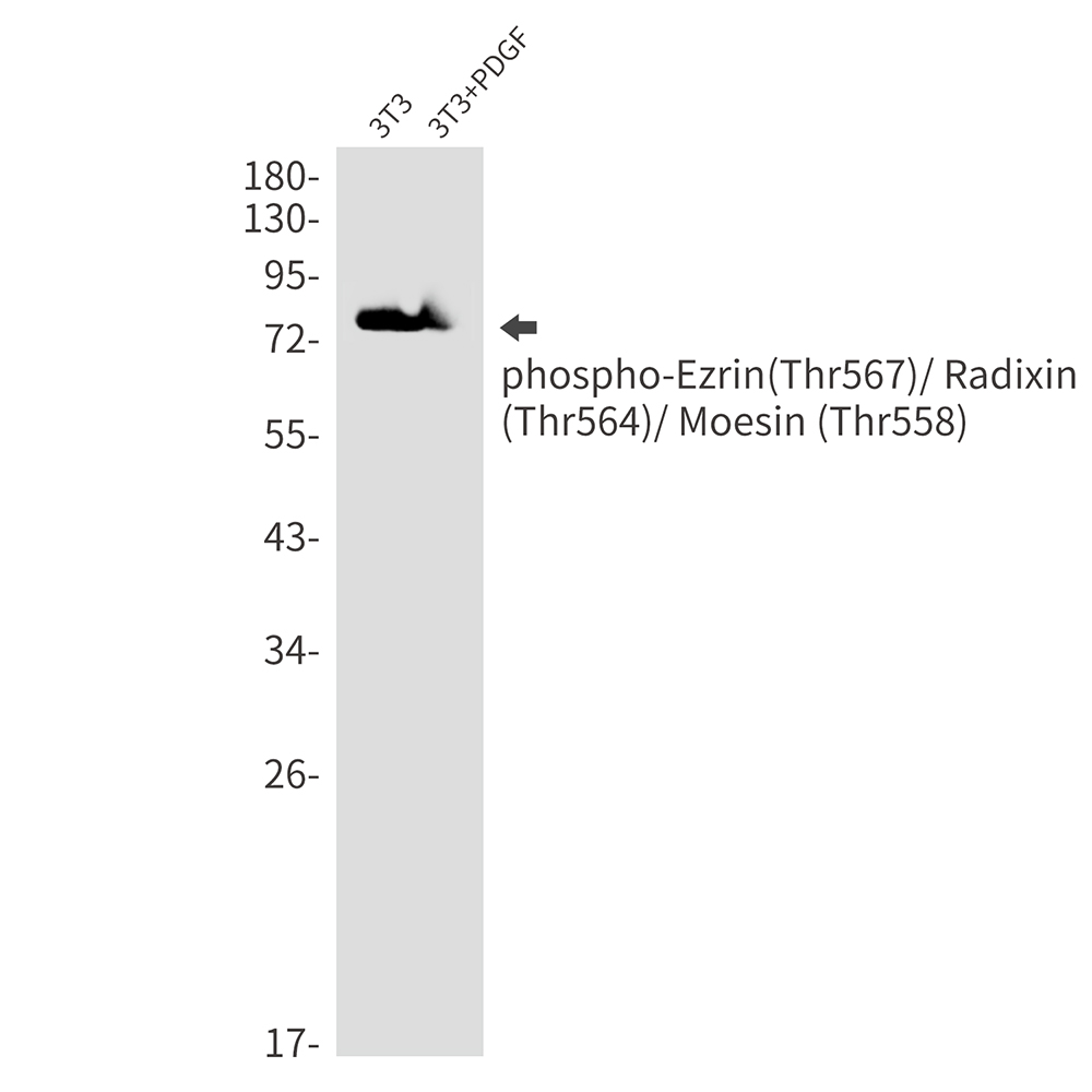 Anti-Phospho-Ezrin/Radixin/Moesin (Thr567/Thr564/Thr558) Rabbit mAb [93L89L19]