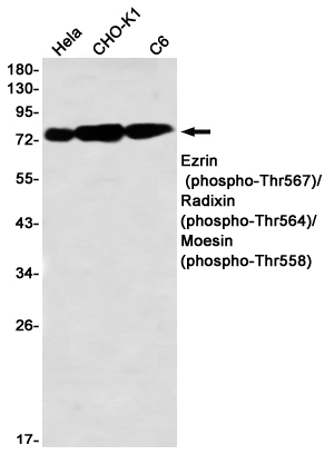 Anti-Phospho-Ezrin/Radixin/Moesin (Thr567/Thr564/Thr558) Rabbit mAb [93L89L19]