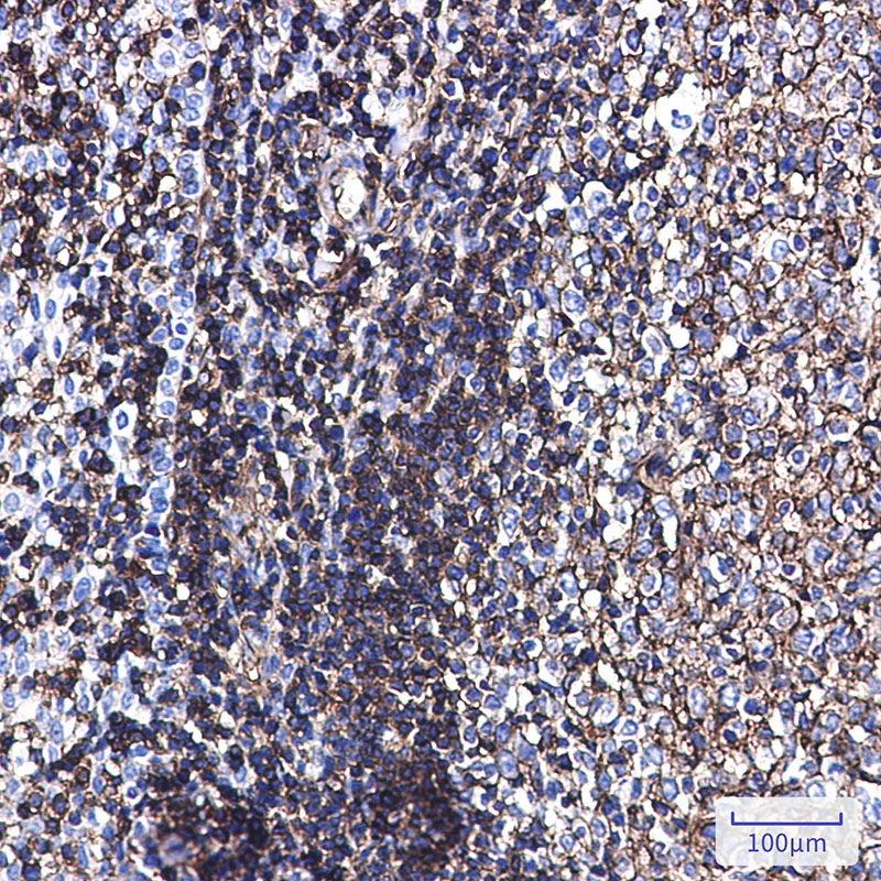 Anti-Phospho-Ezrin/Radixin/Moesin (Thr567/Thr564/Thr558) Rabbit mAb [93L89L19]