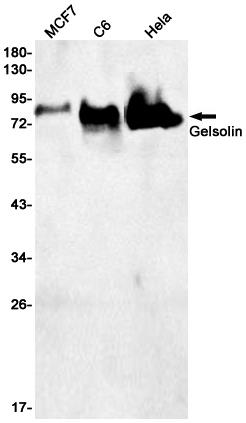 Anti-Gelsolin Rabbit mAb [38M01L52]