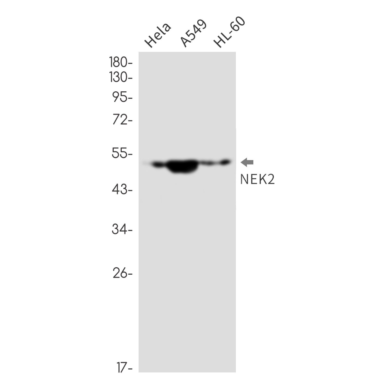 Anti-NEK2 Rabbit mAb [71M55K78]