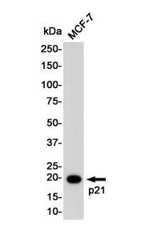 Anti-p21 Rabbit mAb [87K34M53]