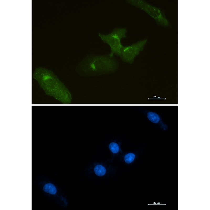 Anti-Tissue Factor Rabbit mAb [83M71K67]